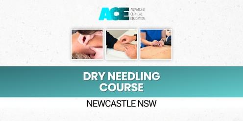 Dry Needling Course (Newcastle NSW)