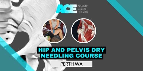 Hip and Pelvis Dry Needling Course (Perth WA)