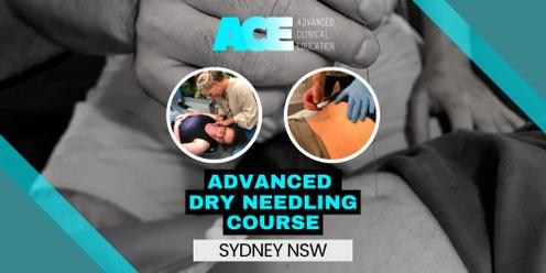 Advanced Dry Needling Course (Sydney NSW)