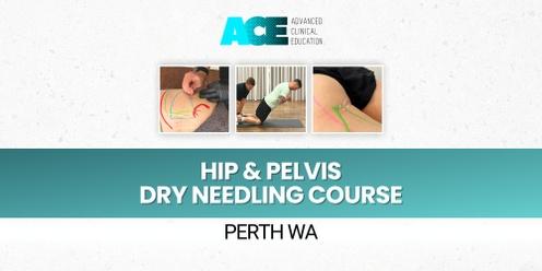 Hip and Pelvis Dry Needling Course (Perth WA)
