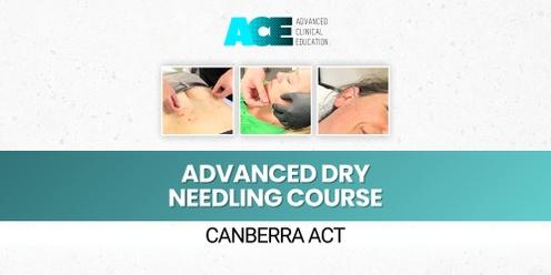 Advanced Dry Needling Course (Canberra ACT)