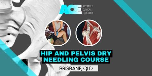 Hip and Pelvis Dry Needling Course (Brisbane QLD)