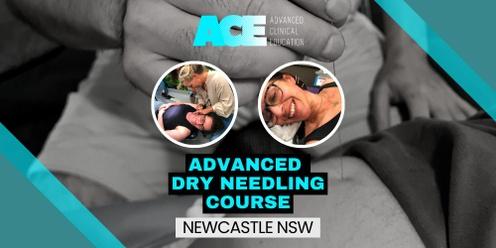 Advanced Dry Needling Course (Newcastle NSW)
