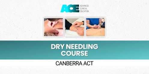 Dry Needling Course (Canberra ACT)